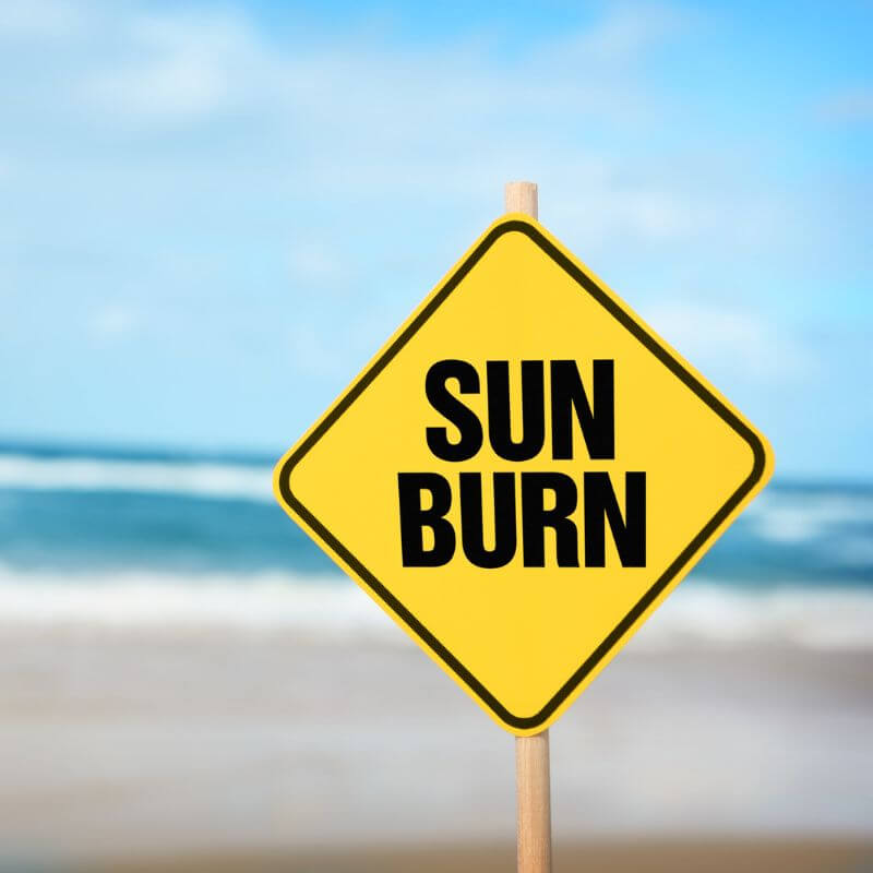 sign saying sun burn